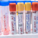 Covid-19: ¿Debemos preocuparnos más por una variante letal que por una más contagiosa?