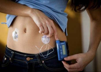 El MSP anunció bombas de insulina de nueva generación, disponibles para jóvenes de hasta 21 años
