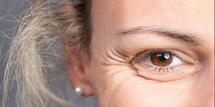 ¿Cómo cuidar la piel de alrededor de los ojos?