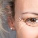 ¿Cómo cuidar la piel de alrededor de los ojos?