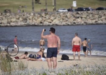 «La sombra te cuida»: consejos para proteger la piel del sol en el verano, evitar ardor y quemaduras
