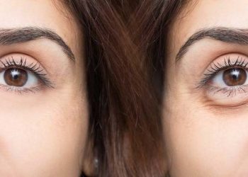 Trucos para eliminar las ojeras y las bolsas de los ojos